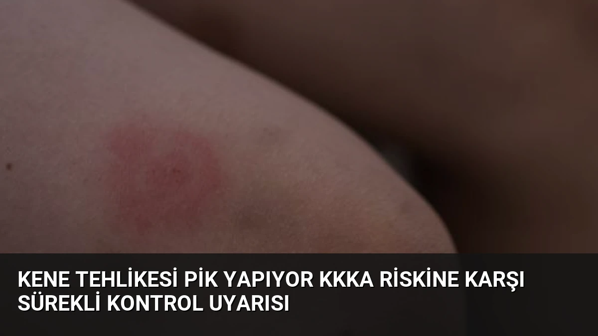 Kene Tehlikesi Pik Yapıyor KKKA Riskine Karşı Sürekli Kontrol Uyarısı