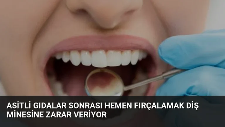 Asitli Gıdalar Sonrası Hemen Fırçalamak Diş Minesine Zarar Veriyor