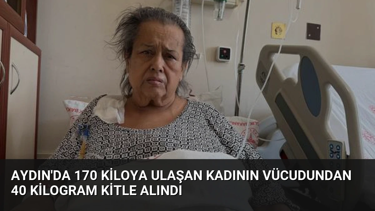 Aydın’da 170 Kiloya Ulaşan Kadının Vücudundan 40 Kilogram Kitle Alındı
