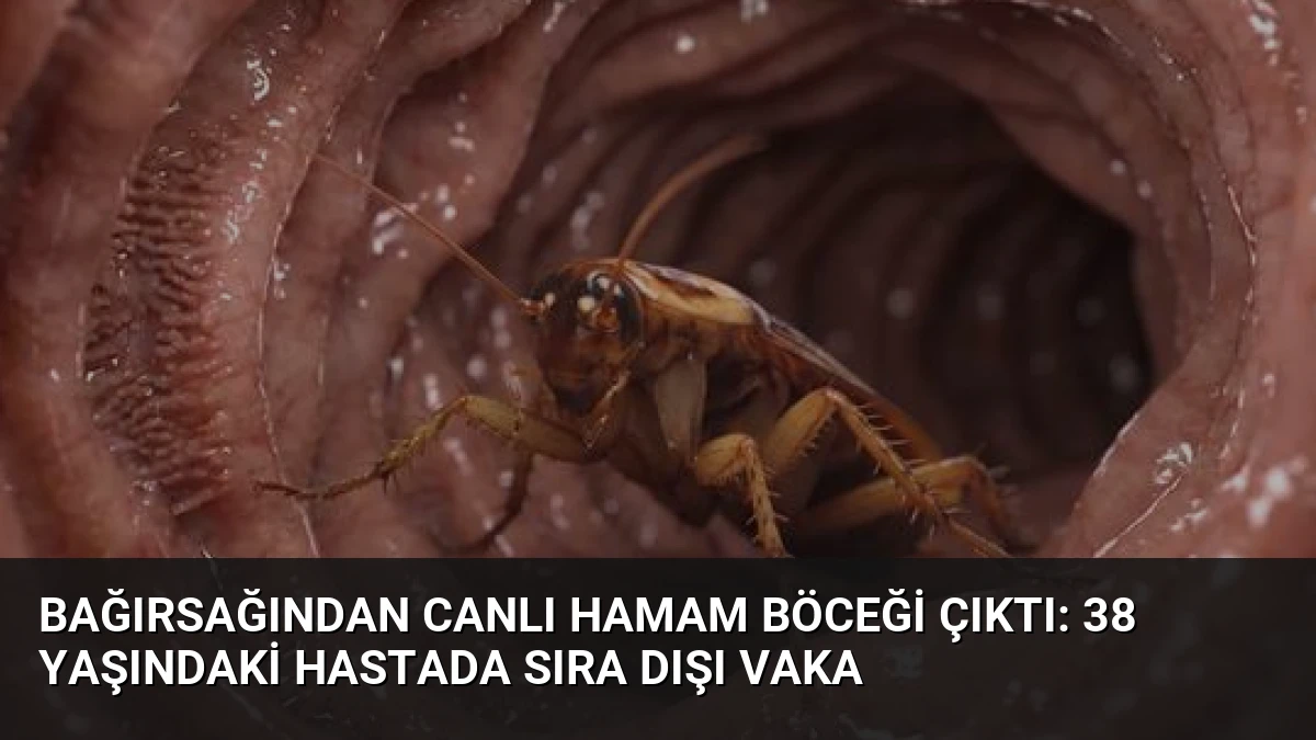 Bağırsağından Canlı Hamam Böceği Çıktı: 38 Yaşındaki Hastada Sıra Dışı Vaka