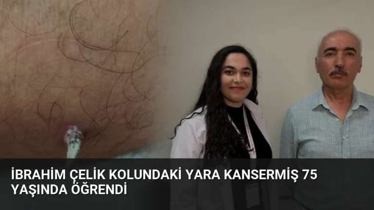 İbrahim Çelik Kolundaki Yara Kansermiş 75 Yaşında Öğrendi