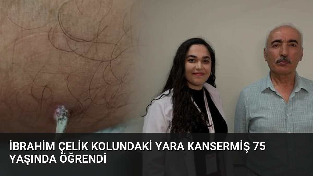 İbrahim Çelik Kolundaki Yara Kansermiş 75 Yaşında Öğrendi