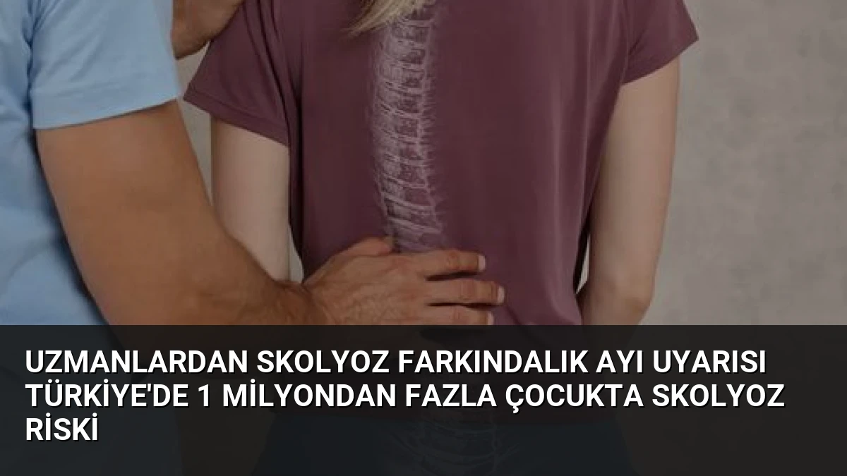 Uzmanlardan Skolyoz Farkındalık Ayı uyarısı Türkiye’de 1 milyondan fazla çocukta skolyoz riski