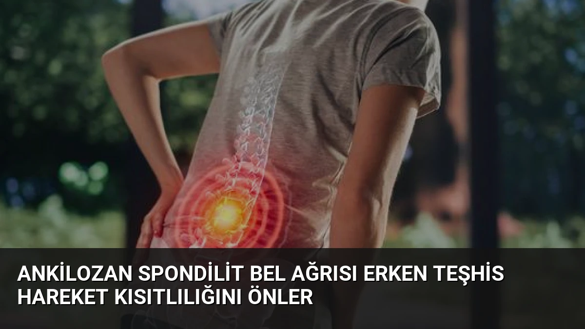 Ankilozan Spondilit Bel Ağrısı Erken Teşhis Hareket Kısıtlılığını Önler