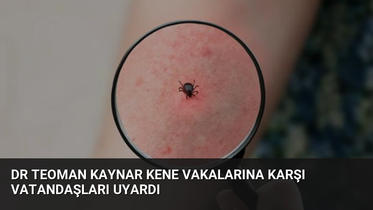 Dr Teoman Kaynar Kene Vakalarına Karşı Vatandaşları Uyardı