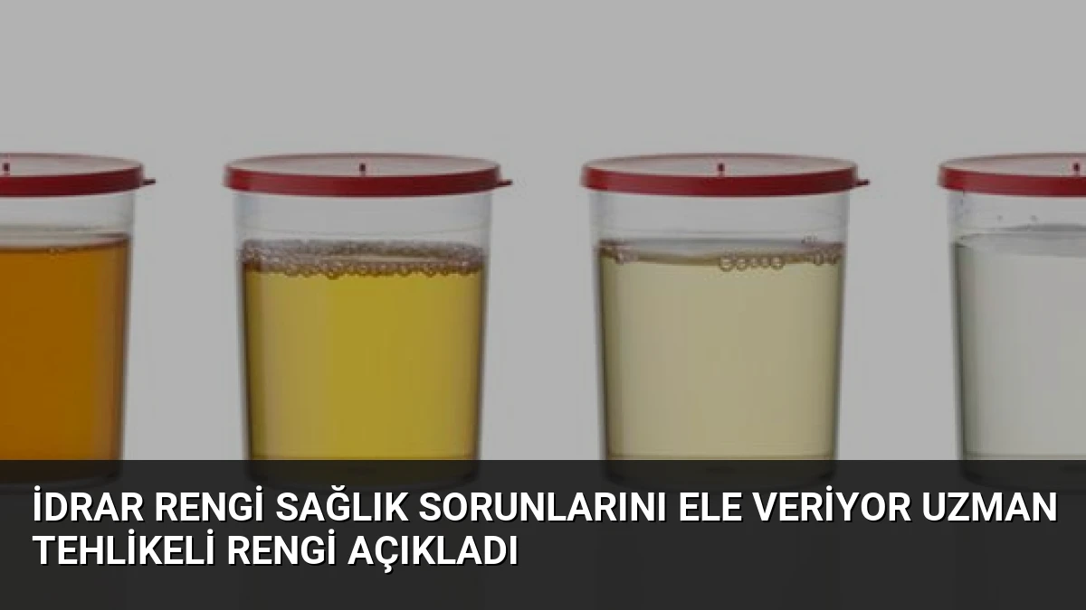 İdrar Rengi Sağlık Sorunlarını Ele Veriyor Uzman Tehlikeli Rengi Açıkladı