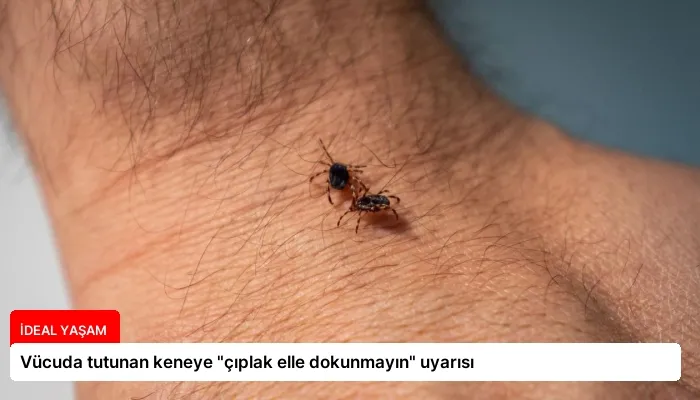 Vücuda tutunan keneye “çıplak elle dokunmayın” uyarısı