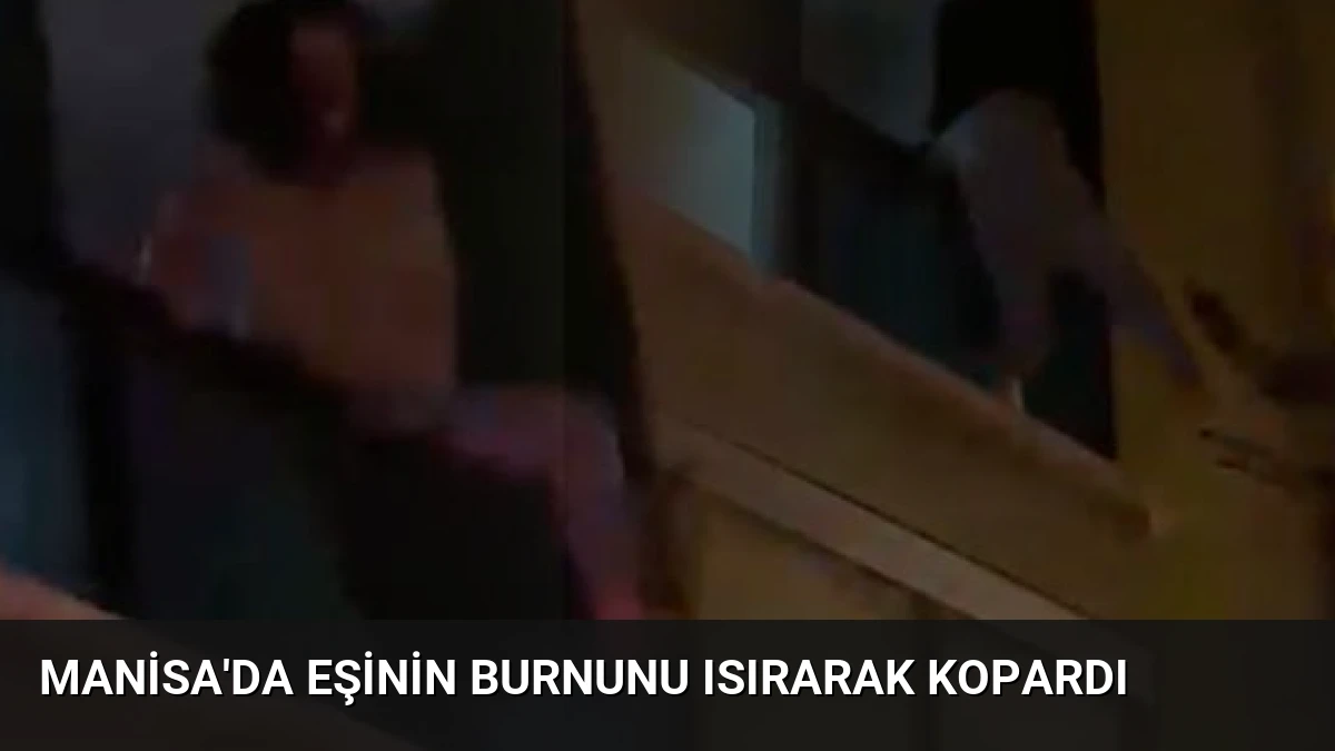 Manisa’da Eşinin Burnunu Isırarak Kopardı