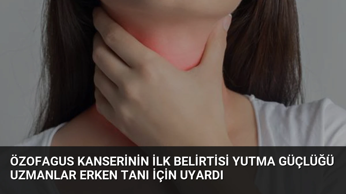 Özofagus Kanserinin İlk Belirtisi Yutma Güçlüğü Uzmanlar Erken Tanı İçin Uyardı