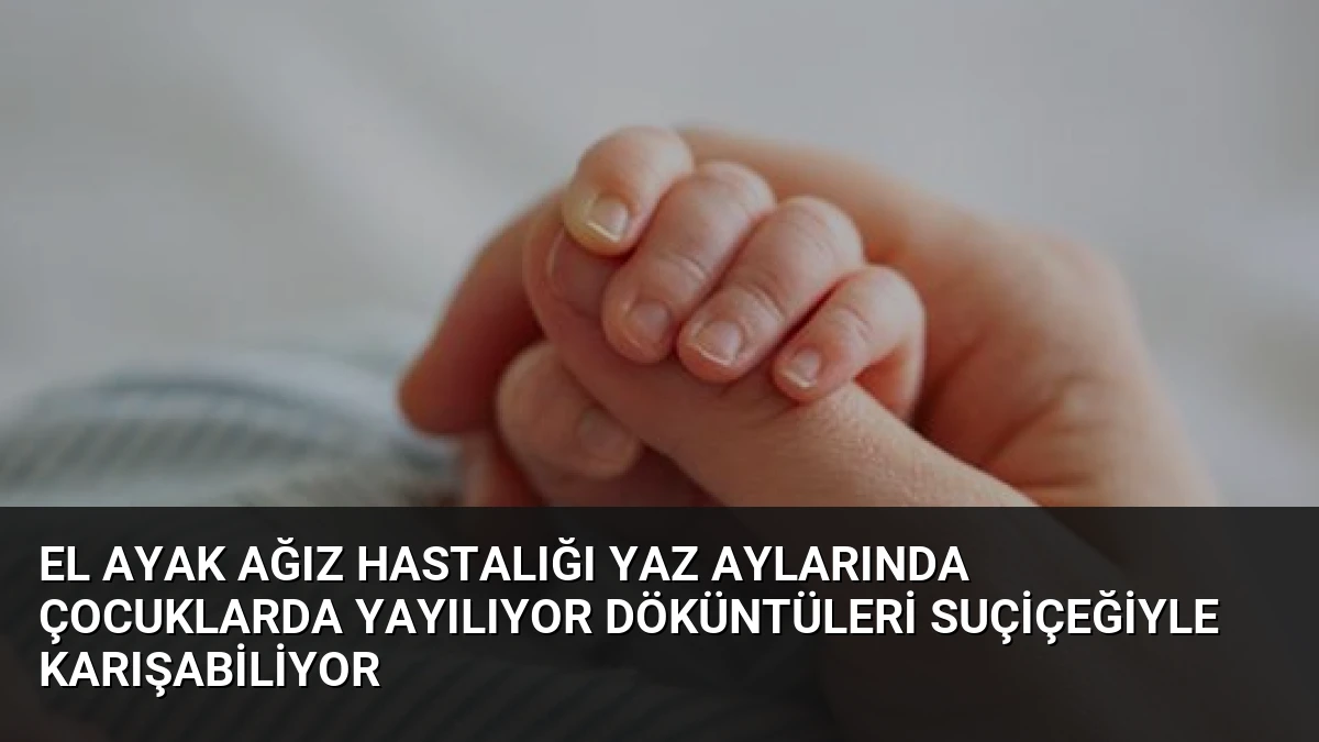 El Ayak Ağız Hastalığı Yaz Aylarında Çocuklarda Yayılıyor Döküntüleri Suçiçeğiyle Karışabiliyor