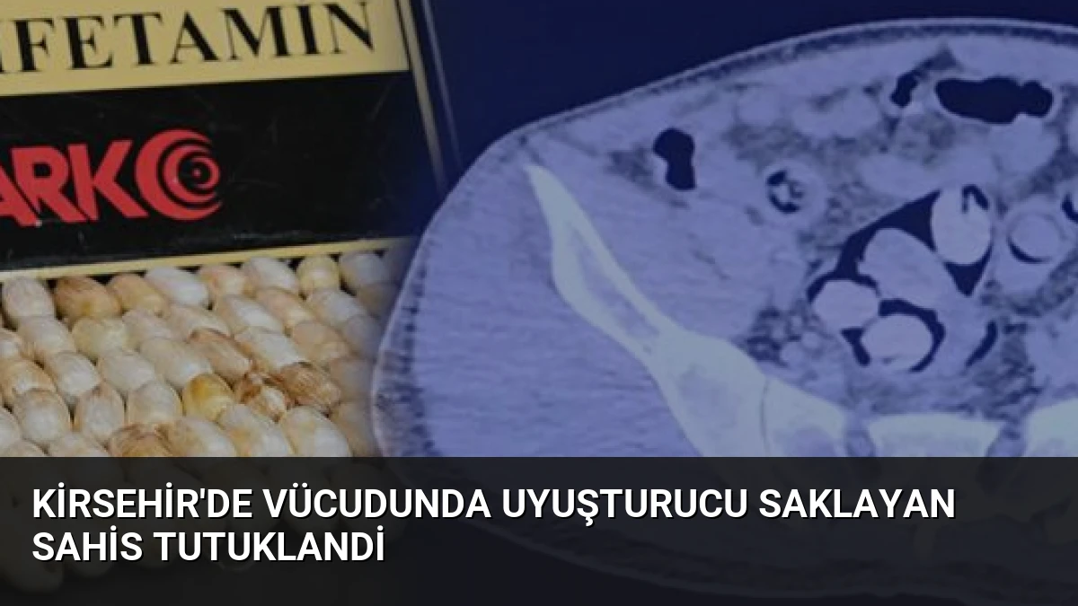 Kirsehir’de Vücudunda Uyuşturucu Saklayan Sahis Tutuklandi