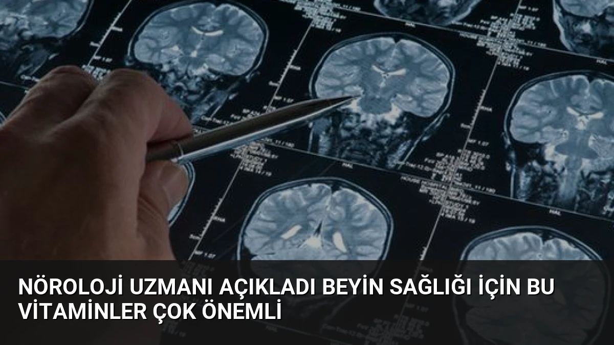 Nöroloji Uzmanı Açıkladı Beyin Sağlığı İçin Bu Vitaminler Çok Önemli