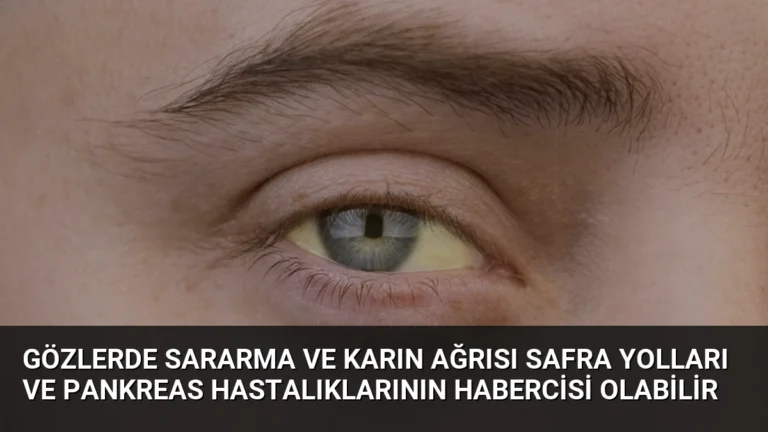 Gözlerde Sararma ve Karın Ağrısı Safra Yolları ve Pankreas Hastalıklarının Habercisi Olabilir