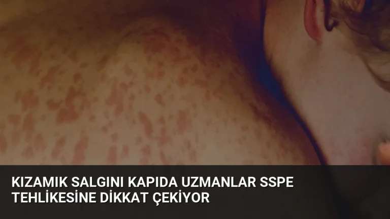 Kızamık Salgını Kapıda Uzmanlar SSPE Tehlikesine Dikkat Çekiyor