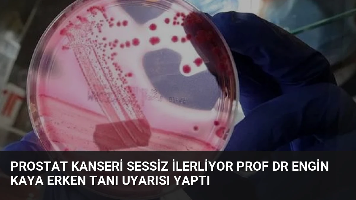 Prostat Kanseri Sessiz İlerliyor Prof Dr Engin Kaya Erken Tanı Uyarısı Yaptı