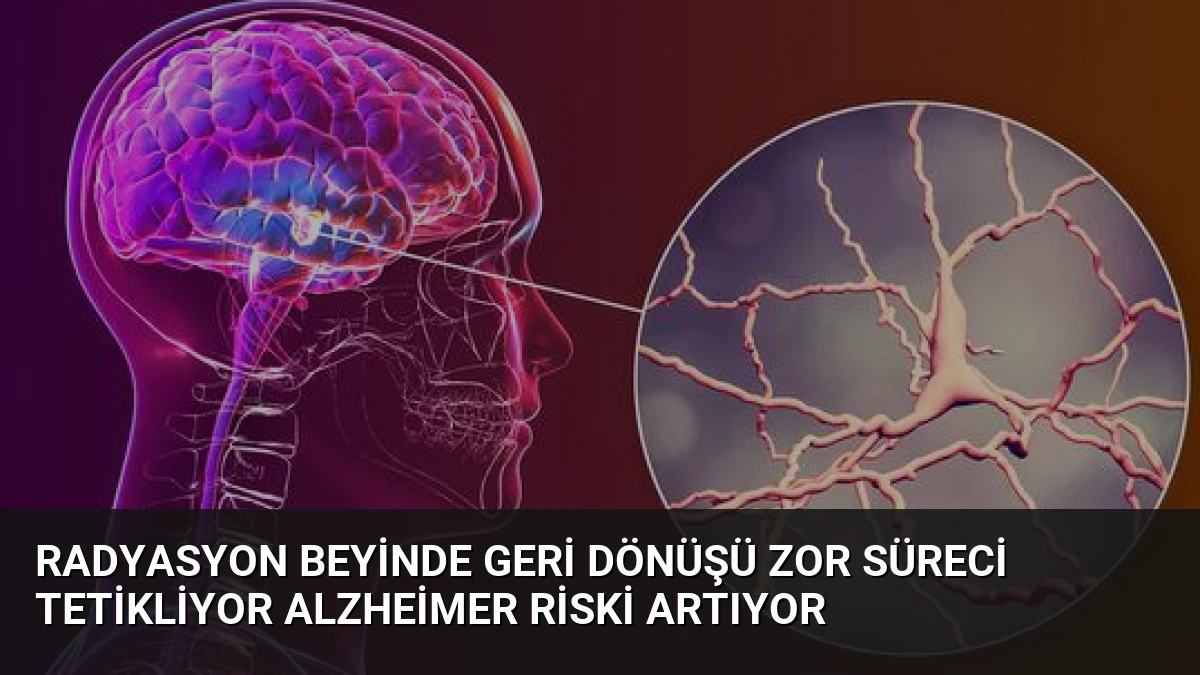 Radyasyon Beyinde Geri Dönüşü Zor Süreci Tetikliyor Alzheimer Riski Artıyor